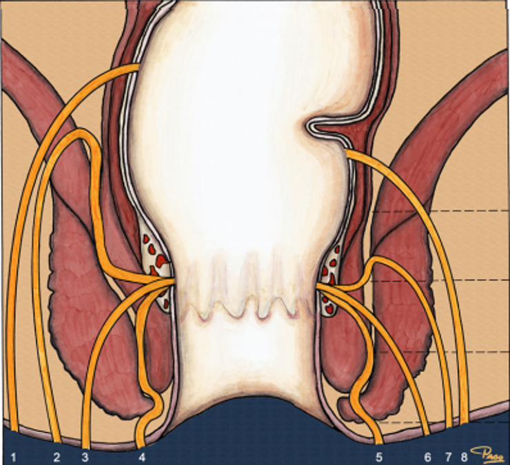 Entendendo a Fístula Anal: Perguntas Frequentes e Respostas – Como prevenir e tratar