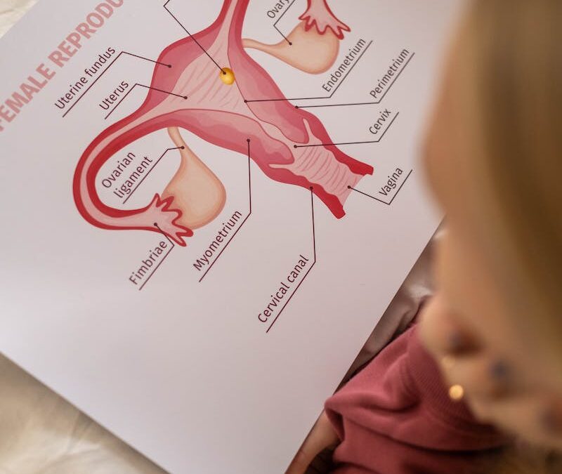 Endometriose no Intestino: Tratamento Eficaz com Equipe Multidisciplinar