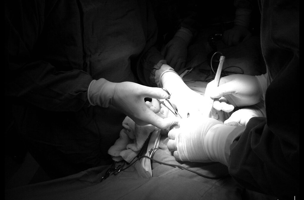 Ligadura Interesfincteriana (LIFT): A Solução Eficaz para Fístula Anal