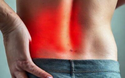 Cirurgia de Fissura Anal: Quando o Botox Não é Suficiente