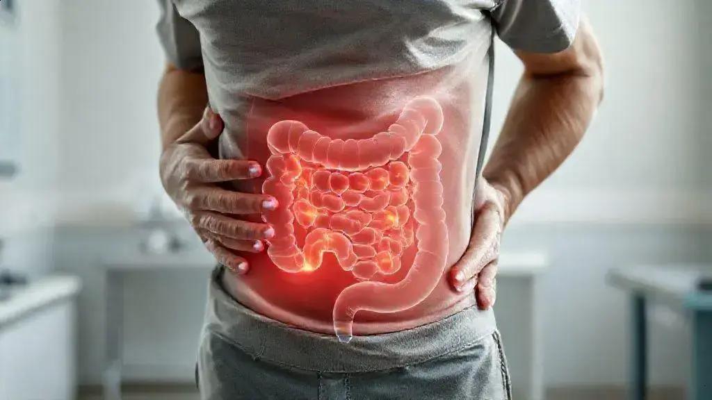 Diverticulite: sinais, riscos e quando procurar atendimento de urgência