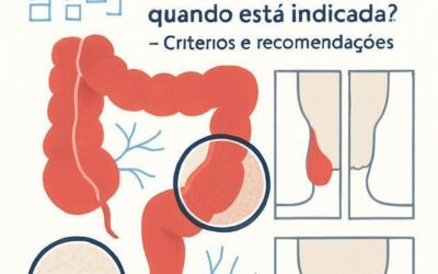 Cirurgia de hemorroidas: quando está indicada?